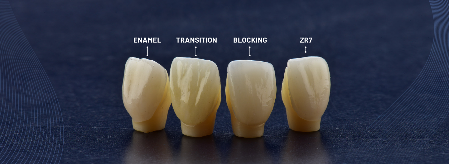 Zirconio Carillas - Laboratorio Dental Luis Milanés